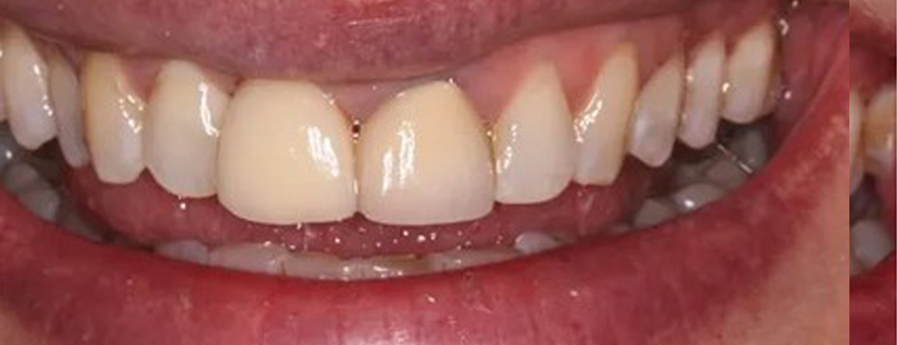 After Image