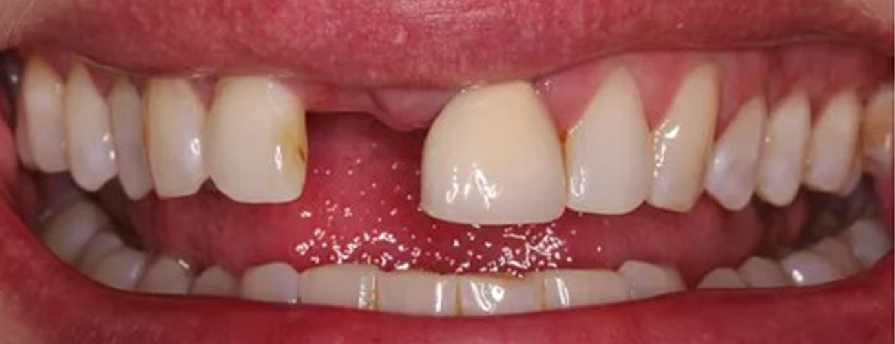 Before Image