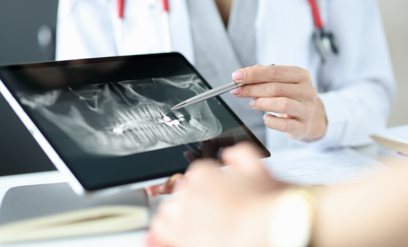 root canal treatment