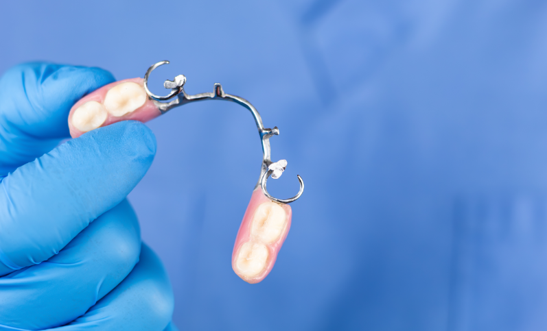 partial denture service