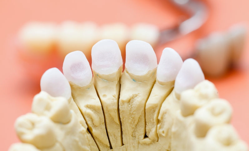 porcelain dental crowns