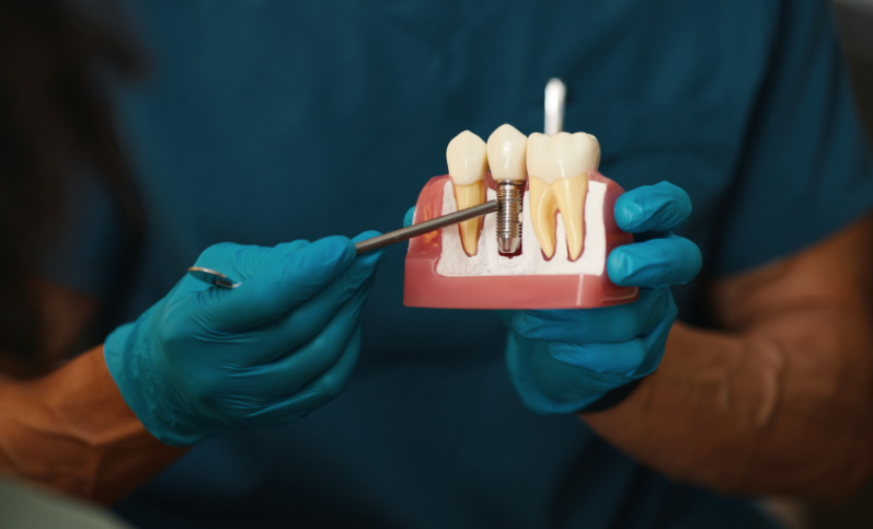 single tooth implant