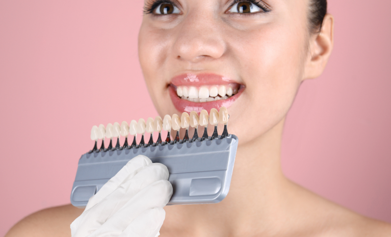 Take-home Whitening Kit
