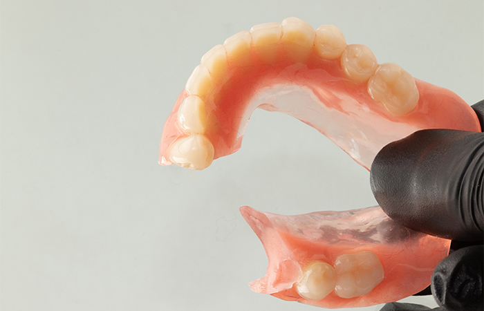 implant-supported overdentures