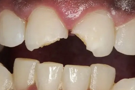 before diagnosis picture