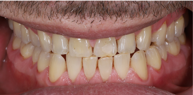 oral treatment after picture